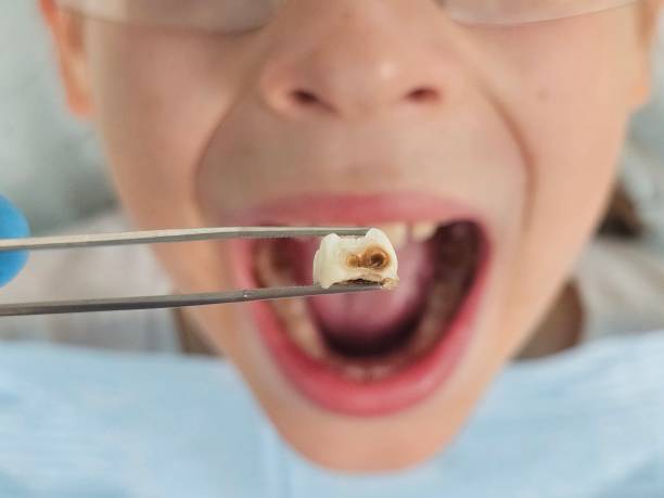 Best Emergency Dental Filling Replacement  in Melvindale, MI