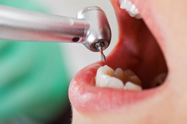 Best Emergency Tooth Extraction  in Melvindale, MI
